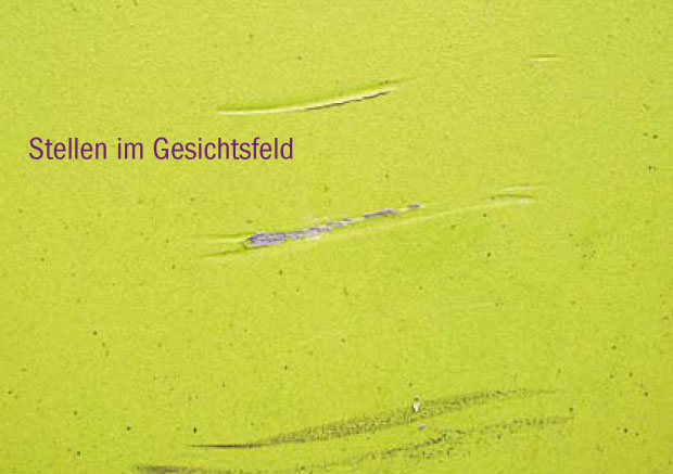 Stellen im Gesichtsfeld